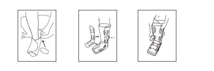 Instruction For Use The Air Walking Boot