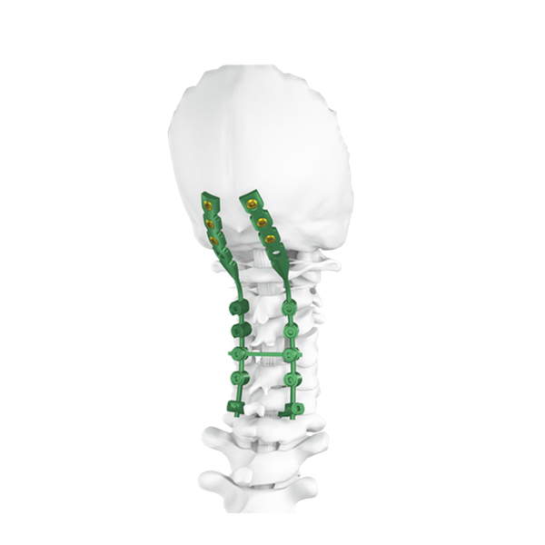 Occipital Posterior Cervical Spine Screw System